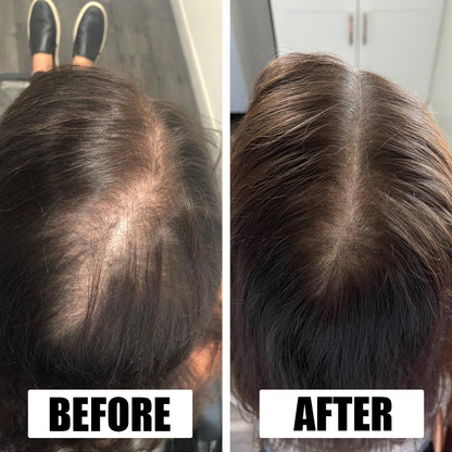 Hair Growth Serum - See Results in 30 Days or Your Money Back